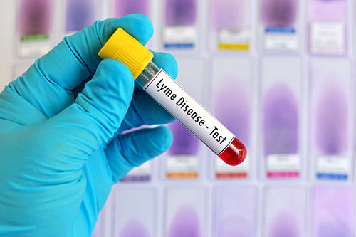 lyme-disease-testing-office
